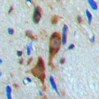 HDAC6 Antibody - Immunohistochemical analysis of Histone Deacetylase 6 (pS22) staining in human brain formalin fixed paraffin embedded tissue section. The section was pre-treated using heat mediated antigen retrieval with sodium citrate buffer (pH 6.0). The section was then incubated with the antibody at room temperature and detected using an HRP conjugated compact polymer system. DAB was used as the chromogen. The section was then counterstained with hematoxylin and mounted with DPX.
