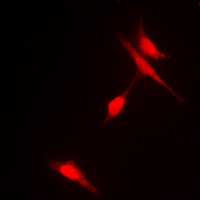 HDAC6 Antibody - Immunofluorescent analysis of Histone Deacetylase 6 (pS22) staining in HeLa cells. Formalin-fixed cells were permeabilized with 0.1% Triton X-100 in TBS for 5-10 minutes and blocked with 3% BSA-PBS for 30 minutes at room temperature. Cells were probed with the primary antibody in 3% BSA-PBS and incubated overnight at 4 deg C in a humidified chamber. Cells were washed with PBST and incubated with a DyLight 594-conjugated secondary antibody (red) in PBS at room temperature in the dark. DAPI was used to stain the cell nuclei (blue).