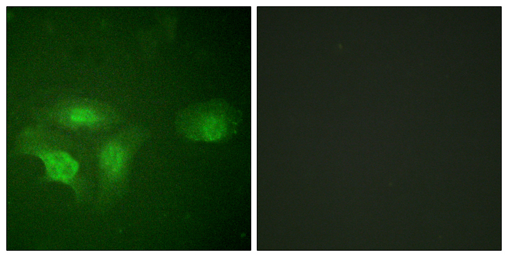 HDAC6 Antibody - Immunofluorescence analysis of HepG2 cells, using HDAC6 (Phospho-Ser22) Antibody. The picture on the right is blocked with the phospho peptide.