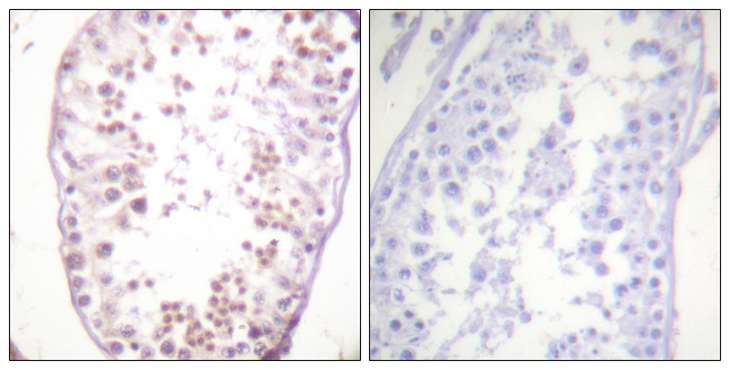 HDAC6 Antibody - Immunohistochemistry analysis of paraffin-embedded human testis, using HDAC6 (Phospho-Ser22) Antibody. The picture on the right is blocked with the phospho peptide.