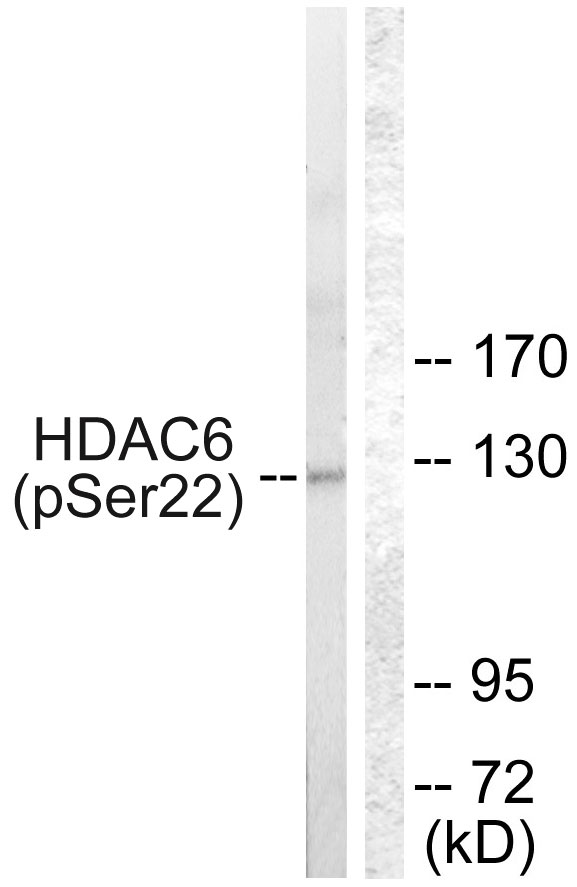 HDAC6 Antibody - Western blot analysis of lysates from NIH/3T3 cells treated with Anisomycin 25ug/ml 30', using HDAC6 (Phospho-Ser22) Antibody. The lane on the right is blocked with the phospho peptide.
