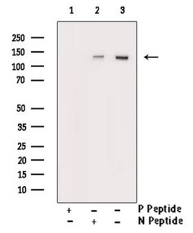 HDAC6 Antibody - Western blot analysis of Phospho-HDAC6 (Ser22) antibody expression in NIH-3T3 cells lysates. The lane on the right is treated with the antigen-specific peptide.