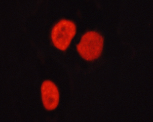 HDAC6 Antibody - Staining HepG2 cells by IF/ICC. The samples were fixed with PFA and permeabilized in 0.1% saponin prior to blocking in 10% serum for 45 min at 37°C. The primary antibody was diluted 1/400 and incubated with the sample for 1 hour at 37°C. A Alexa Fluor 594 conjugated goat polyclonal to rabbit IgG (H+L), diluted 1/600 was used as secondary antibody.