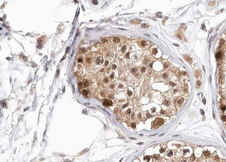 HDAC6 Antibody - 1:100 staining human Testis tissue by IHC-P. The tissue was formaldehyde fixed and a heat mediated antigen retrieval step in citrate buffer was performed. The tissue was then blocked and incubated with the antibody for 1.5 hours at 22°C. An HRP conjugated goat anti-rabbit antibody was used as the secondary.