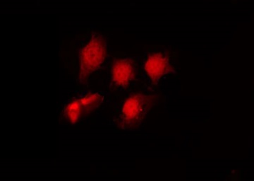 HDAC6 Antibody - Staining NIH-3T3 cells by IF/ICC. The samples were fixed with PFA and permeabilized in 0.1% Triton X-100, then blocked in 10% serum for 45 min at 25°C. The primary antibody was diluted at 1:200 and incubated with the sample for 1 hour at 37°C. An Alexa Fluor 594 conjugated goat anti-rabbit IgG (H+L) Ab, diluted at 1/600, was used as the secondary antibody.