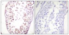 HDAC6 Antibody - P-peptide - + Immunohistochemistry analysis of paraffin-embedded human testis tissue using HDAC6 (Phospho-Ser22) antibody.