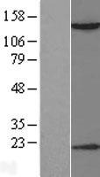 HDAC6 Protein - Western validation with an anti-DDK antibody * L: Control HEK293 lysate R: Over-expression lysate