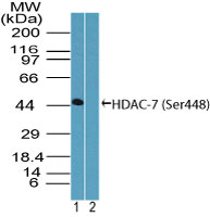 HDAC7 Antibody - Western blot of phosphorylated HDAC-7 in (A) recombinant fusion protein containing Ser448 and (B) fusion protein without the phosphorylated amino acid, using Peptide-affinity Purified Polyclonal Antibody to HDAC-7 (Ser448) at 0.1 ug/ml.