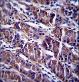 HDAC7 Antibody - HDAC7 Antibody immunohistochemistry of formalin-fixed and paraffin-embedded human stomach tissue followed by peroxidase-conjugated secondary antibody and DAB staining.