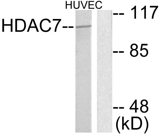 HDAC7 Antibody - Western blot analysis of lysates from HUVEC cells, using HDAC7 Antibody. The lane on the right is blocked with the synthesized peptide.