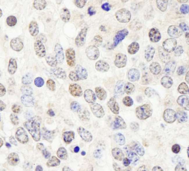 HDAC7 Antibody - Detection of Mouse HDAC7 by Immunohistochemistry. Sample: FFPE section of mouse teratoma. Antibody: Affinity purified rabbit anti-HDAC7 used at a dilution of 1:100.