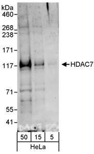 HDAC7 Antibody - Detection of Human HDAC7 by Western Blot. Samples: Whole cell lysate (5, 15 and 50 ug) from HeLa cells. Antibody: Affinity purified rabbit anti-HDAC7 antibody used for WB at 0.4 ug/ml. Detection: Chemiluminescence with an exposure time of 1 minute.