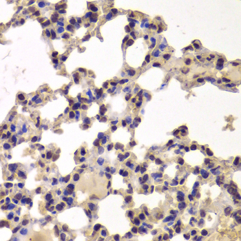 HDAC7 Antibody - Immunohistochemistry of paraffin-embedded Mouse lung tissue.