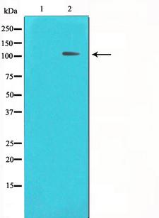 HDAC7 Antibody - Western blot analysis on HeLa cell lysates using HDAC7 antibody. The lane on the left is treated with the antigen-specific peptide.