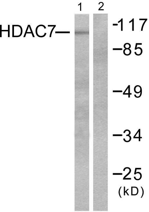 HDAC7 Antibody - Western blot analysis of extracts from HuvEc cells, using HDAC7 antibody.