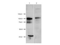 HDAC7 Antibody - Western Blot of Rabbit anti-HDAC7 antibody. Lane 1: mouse brain homogenate. Lane 2: mouse brain homogenate blocked with peptide. Load: 4 ug per lane. Primary antibody: HDAC7 antibody at 1ug/mL for overnight at 4 degrees C. Secondary antibody: HRP rabbit secondary antibody at 1:40,000 for 45 min at RT. Block: 5% BLOTTO overnight at 4 degrees C. Predicted/Observed size: ~103kDa/ ~103, 70, and 40kDa for HDAC7. Other band(s): HDAC7 isoforms ~70 and 40kDa.