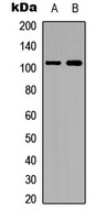 HDAC7 Antibody - Western blot analysis of Histone Deacetylase 7 (pS155) expression in HepG2 (A); HeLa (B) whole cell lysates.