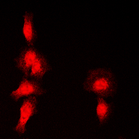 HDAC7 Antibody - Immunofluorescent analysis of Histone Deacetylase 7 (pS155) staining in HepG2 cells. Formalin-fixed cells were permeabilized with 0.1% Triton X-100 in TBS for 5-10 minutes and blocked with 3% BSA-PBS for 30 minutes at room temperature. Cells were probed with the primary antibody in 3% BSA-PBS and incubated overnight at 4 ??C in a humidified chamber. Cells were washed with PBST and incubated with a DyLight 594-conjugated secondary antibody (red) in PBS at room temperature in the dark. DAPI was used to stain the cell nuclei (blue).