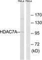 HDAC7 Antibody - Western blot analysis of extracts from HeLa cells, using HDAC7A(Ab-155) antibody.