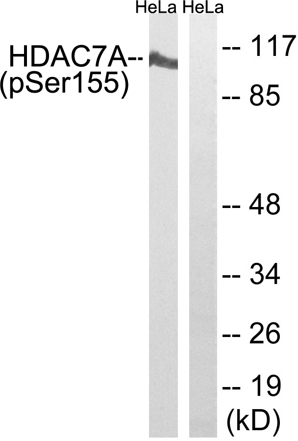 HDAC7 Antibody - Western blot analysis of lysates from HeLa cells, using HDAC7A (Phospho-Ser155) Antibody. The lane on the right is blocked with the phospho peptide.