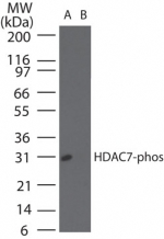 HDAC7 Antibody - Western blot of phosphorylatedHDAC-7in (A) recombinant fusion protein containing a phosphorylated serine at position155and (B) fusion protein containing an unphosphorylated serine at position 155, using antibody at 0.1 ug/ml.