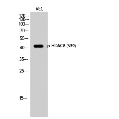 HDAC8 Antibody - Western blot of Phospho-HDAC8 (S39) antibody