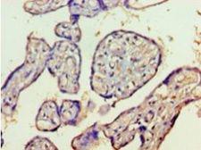 HDAC8 Antibody - Immunohistochemistry of paraffin-embedded human placenta tissue using antibody at 1:100 dilution.  This image was taken for the unconjugated form of this product. Other forms have not been tested.