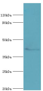 HDAC8 Antibody - Western blot. All lanes: Histone deacetylase 8 antibody at 2 ug/ml+HeLa whole cell lysate. Secondary antibody: Goat polyclonal to rabbit at 1:10000 dilution. Predicted band size: 42 kDa. Observed band size: 42 kDa Immunohistochemistry.