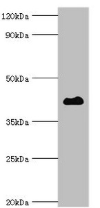 HDAC8 Antibody - Western blot Western blot All lanes: Histone deacetylase 8 antibody at 2µg/ml + Hela whole cell lysate Secondary Goat polyclonal to rabbit IgG at 1/10000 dilution Predicted band size: 42, 30, 18, 32, 29, 16, 17 kDa Observed band size: 42 kDa
