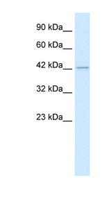 HDAC8 Antibody - HDAC8 antibody Western blot of Jurkat lysate. This image was taken for the unconjugated form of this product. Other forms have not been tested.