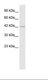HDAC8 Antibody - Jurkat Cell Lysate.  This image was taken for the unconjugated form of this product. Other forms have not been tested.