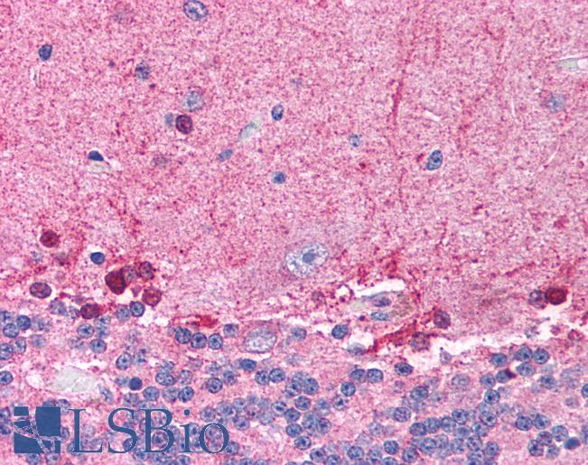 HDAC8 Antibody - Anti-HDAC8 antibody IHC of human brain, cerebellum. Immunohistochemistry of formalin-fixed, paraffin-embedded tissue after heat-induced antigen retrieval. Antibody concentration 5 ug/ml.  This image was taken for the unconjugated form of this product. Other forms have not been tested.