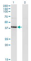 HDAC8 Antibody - Western blot of HDAC8 expression in transfected 293T cell line by HDAC8 monoclonal antibody (M07), clone 2F4.