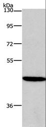 HDAC8 Antibody - Western blot analysis of 293T cell, using HDAC8 Polyclonal Antibody at dilution of 1:950.