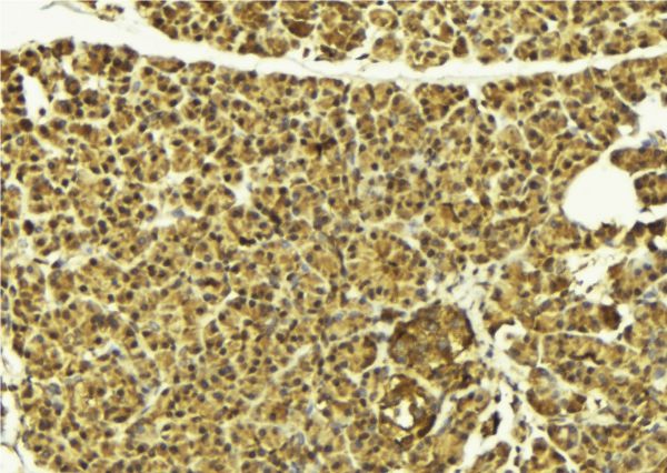 HDAC8 Antibody - 1:100 staining mouse pancreas tissue by IHC-P. The sample was formaldehyde fixed and a heat mediated antigen retrieval step in citrate buffer was performed. The sample was then blocked and incubated with the antibody for 1.5 hours at 22°C. An HRP conjugated goat anti-rabbit antibody was used as the secondary.