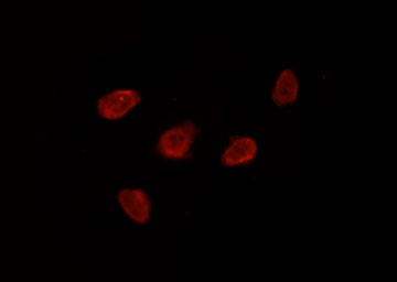 HDAC8 Antibody - Staining HeLa cells by IF/ICC. The samples were fixed with PFA and permeabilized in 0.1% Triton X-100, then blocked in 10% serum for 45 min at 25°C. The primary antibody was diluted at 1:200 and incubated with the sample for 1 hour at 37°C. An Alexa Fluor 594 conjugated goat anti-rabbit IgG (H+L) Ab, diluted at 1/600, was used as the secondary antibody.