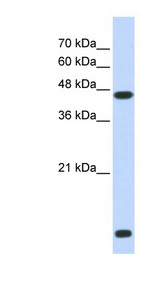 HDAC8 Antibody - HDAC8 antibody Western blot of Transfected 293T cell lysate. This image was taken for the unconjugated form of this product. Other forms have not been tested.