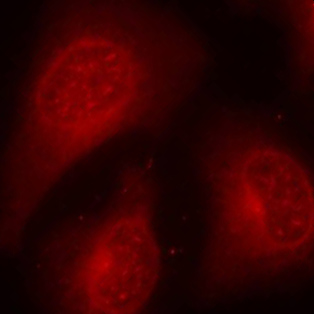 HDAC8 Antibody - Immunofluorescence staining of methanol-fixed Hela cells.
