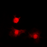 HDAC8 Antibody - Immunofluorescent analysis of Histone Deacetylase 8 (pS39) staining in A549 cells. Formalin-fixed cells were permeabilized with 0.1% Triton X-100 in TBS for 5-10 minutes and blocked with 3% BSA-PBS for 30 minutes at room temperature. Cells were probed with the primary antibody in 3% BSA-PBS and incubated overnight at 4 C in a humidified chamber. Cells were washed with PBST and incubated with a DyLight 594-conjugated secondary antibody (red) in PBS at room temperature in the dark. DAPI was used to stain the cell nuclei (blue).