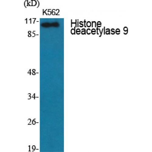 HDAC9 Antibody - Western blot of Histone deacetylase 9 antibody