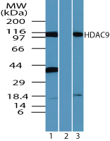 HDAC9 Antibody - Western blot of HDAC-9 in human HeLa cell lysate in the 1) absence and 2) presence of immunizing peptide and 3) and mouse RAW cell lysate using Peptide-affinity Purified Polyclonal Antibody to HDAC-9 at 1.0 ug/ml, 1.0 ug/ml and 0.5 ug/ml respectively. Goat anti-rabbit Ig HRP secondary antibody, and PicoTect ECL substrate solution, were used for this test.
