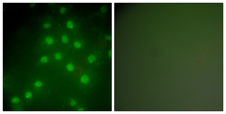 HDAC9 Antibody - Immunofluorescence analysis of HepG2 cells, using HDAC9 Antibody. The picture on the right is blocked with the synthesized peptide.