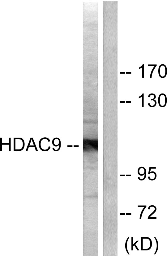 HDAC9 Antibody - Western blot analysis of lysates from HepG2 cells, using HDAC9 Antibody. The lane on the right is blocked with the synthesized peptide.