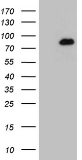 HDAC9 Antibody - HEK293T cells were transfected with the pCMV6-ENTRY control. (Left lane) or pCMV6-ENTRY HDAC9. (Right lane) cDNA for 48 hrs and lysed. Equivalent amounts of cell lysates. (5 ug per lane) were separated by SDS-PAGE and immunoblotted with anti-HDAC9. (1:500)