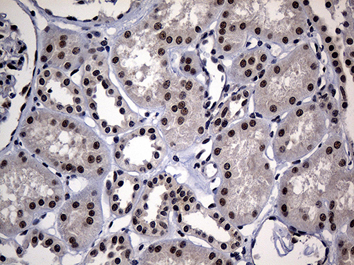 HDAC9 Antibody - Immunohistochemical staining of paraffin-embedded Human Kidney tissue within the normal limits using anti-HDAC9 mouse monoclonal antibody. (Heat-induced epitope retrieval by 1mM EDTA in 10mM Tris buffer. (pH8.5) at 120°C for 3 min. (1:150)