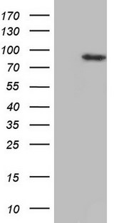 HDAC9 Antibody - HEK293T cells were transfected with the pCMV6-ENTRY control. (Left lane) or pCMV6-ENTRY HDAC9. (Right lane) cDNA for 48 hrs and lysed. Equivalent amounts of cell lysates. (5 ug per lane) were separated by SDS-PAGE and immunoblotted with anti-HDAC9.