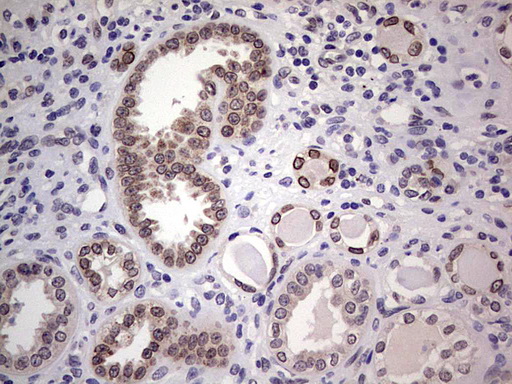 HDAC9 Antibody - Immunohistochemical staining of paraffin-embedded Human Kidney tissue within the normal limits using anti-HDAC9 mouse monoclonal antibody. (Heat-induced epitope retrieval by 1 mM EDTA in 10mM Tris, pH8.5, 120C for 3min,