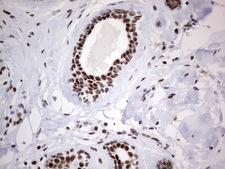 HDAC9 Antibody - Immunohistochemical staining of paraffin-embedded Human breast tissue within the normal limits using anti-HDAC9 mouse monoclonal antibody. (Heat-induced epitope retrieval by 1 mM EDTA in 10mM Tris, pH8.5, 120C for 3min,