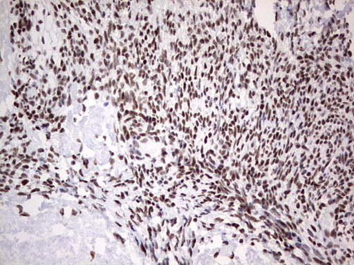 HDAC9 Antibody - Immunohistochemical staining of paraffin-embedded Human Ovary tissue within the normal limits using anti-HDAC9 mouse monoclonal antibody. (Heat-induced epitope retrieval by 1 mM EDTA in 10mM Tris, pH8.5, 120C for 3min,