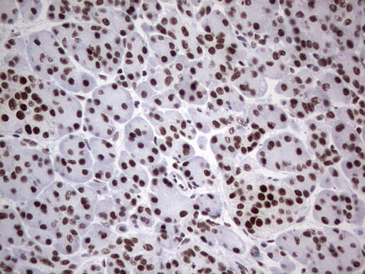HDAC9 Antibody - Immunohistochemical staining of paraffin-embedded Human pancreas tissue within the normal limits using anti-HDAC9 mouse monoclonal antibody. (Heat-induced epitope retrieval by 1 mM EDTA in 10mM Tris, pH8.5, 120C for 3min,
